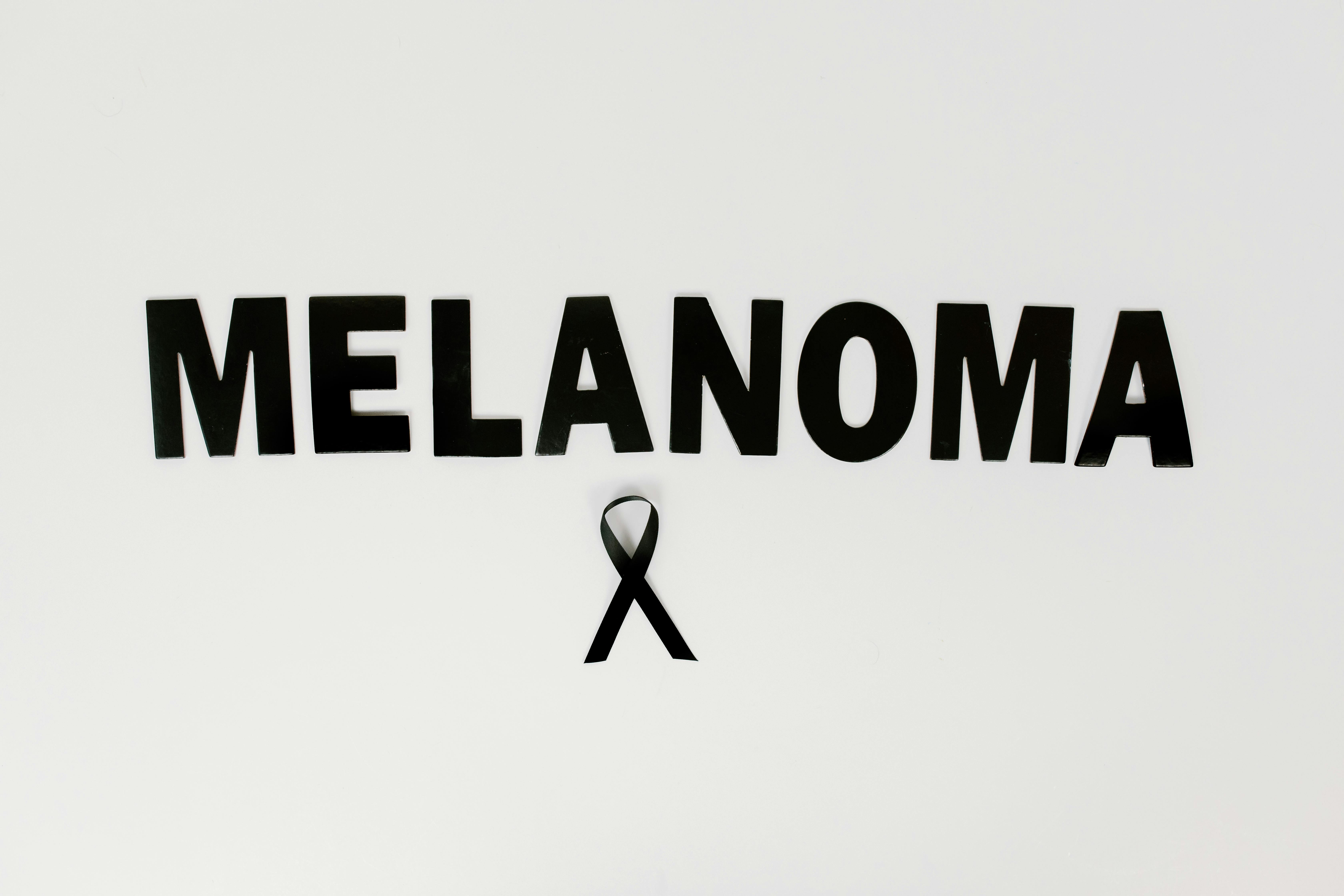 Atipični madeži i rizik melanoma: što znače i treba li ih ukloniti?