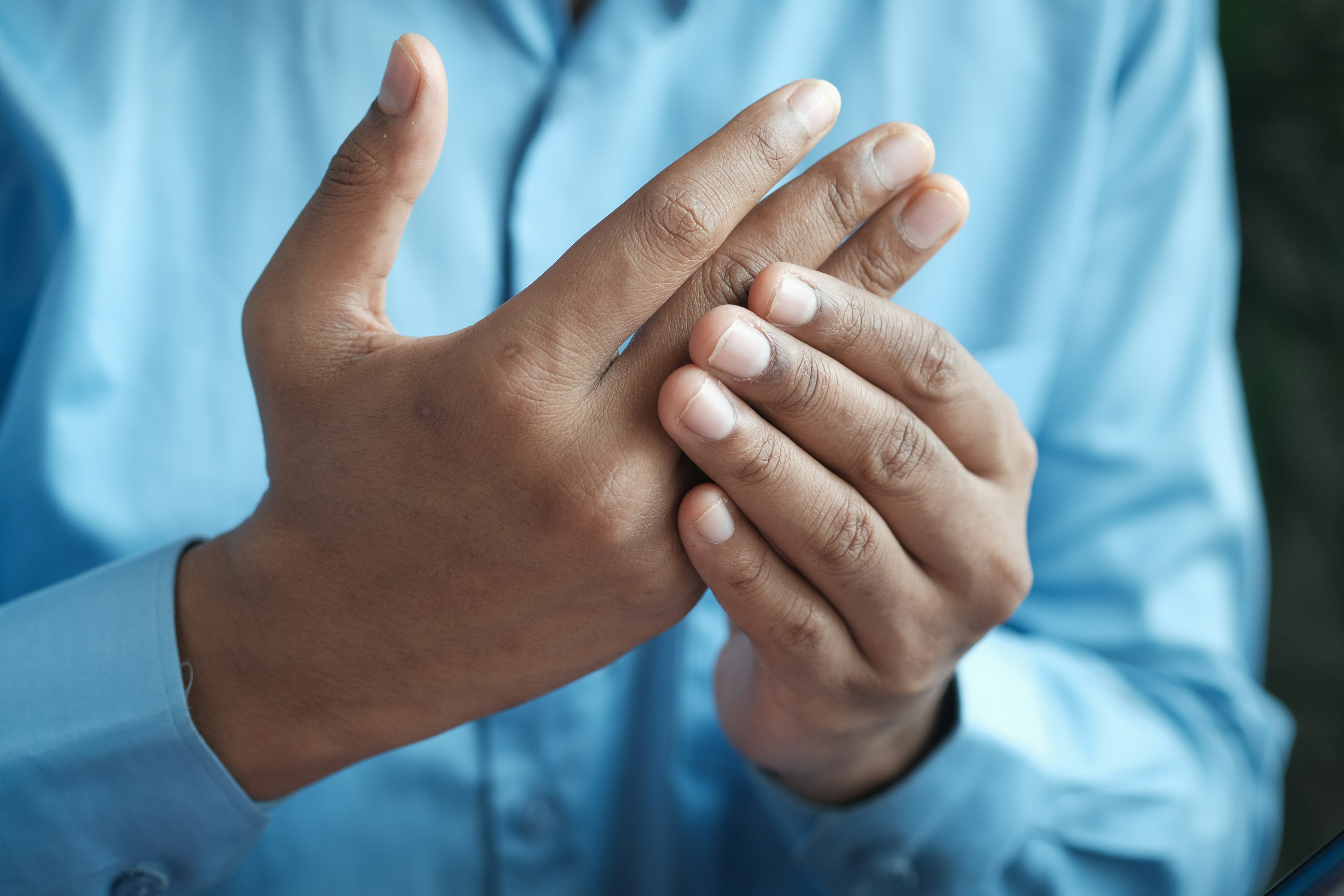 Kada je to psorijatični artritis? Rani znakovi i što učiniti